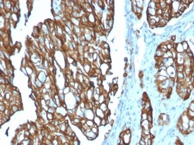 TACSTD2 / TROP2 Monoclonal Mouse Antibody (TACSTD2/2151)