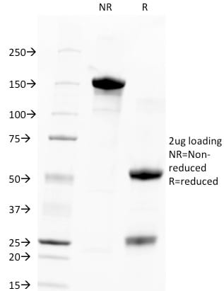 TACSTD2 / TROP2 Monoclonal Mouse Antibody (TACSTD2/2151)