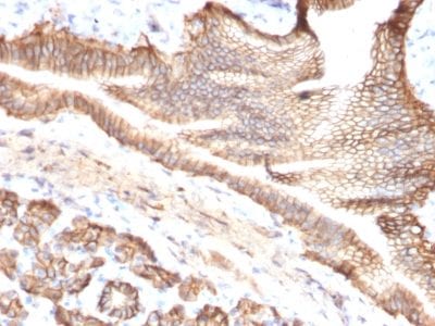 TACSTD2 / TROP2 Monoclonal Mouse Antibody (TACSTD2/2151)