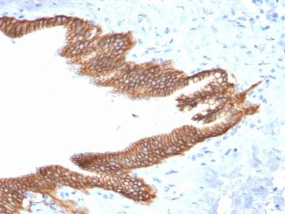 TACSTD2 / TROP2 Monoclonal Mouse Antibody (TACSTD2/2152)