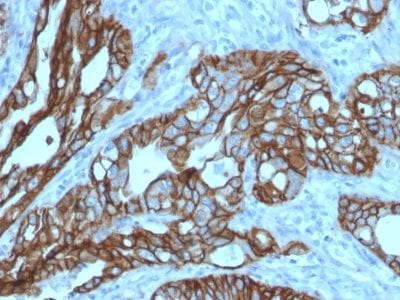 TACSTD2 / TROP2 Monoclonal Mouse Antibody (TACSTD2/2152)