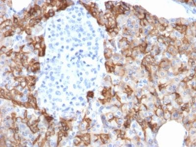 TACSTD2 / TROP2 Monoclonal Mouse Antibody (TACSTD2/2152)