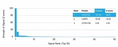 TACSTD2 / TROP2 Monoclonal Mouse Antibody (TACSTD2/2152)
