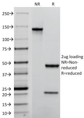 TACSTD2 / TROP2 Monoclonal Mouse Antibody (TACSTD2/2152)