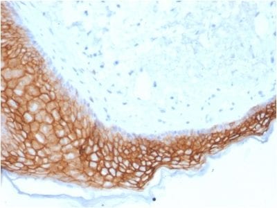 TACSTD2 / TROP2 Monoclonal Mouse Antibody (TACSTD2/2153)