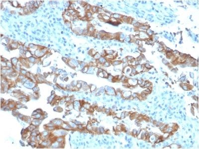 TACSTD2 / TROP2 Monoclonal Mouse Antibody (TACSTD2/2153)