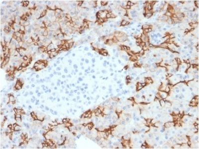 TACSTD2 / TROP2 Monoclonal Mouse Antibody (TACSTD2/2153)