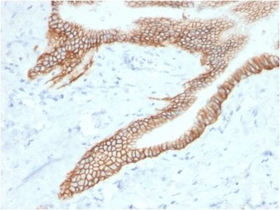 TACSTD2 / TROP2 Monoclonal Mouse Antibody (TACSTD2/2153)
