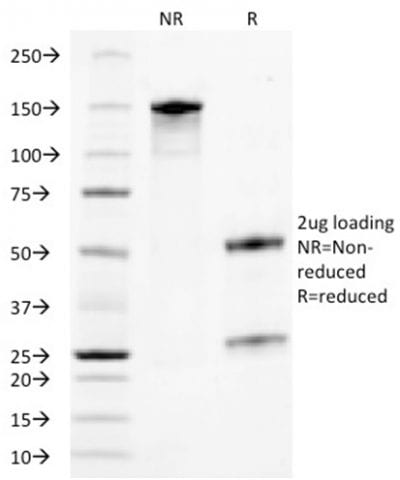 TACSTD2 / TROP2 Monoclonal Mouse Antibody (TACSTD2/2153)