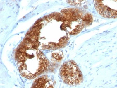 TAG-72 / CA72.4 Monoclonal Mouse Antibody (B72.3 + CA72/733)
