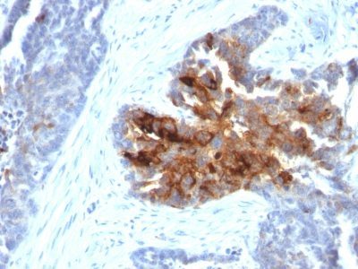 TAG-72 / CA72.4 Monoclonal Mouse Antibody (B72.3 + CA72/733)