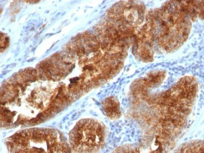 TAG-72 / CA72.4 Monoclonal Mouse Antibody (B72.3 + CC49)