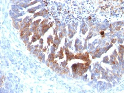 TAG-72 / CA72.4 Monoclonal Mouse Antibody (B72.3 + CC49)