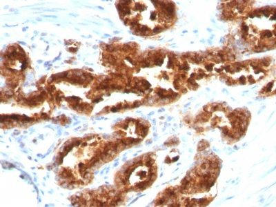 TAG-72 / CA72.4 Monoclonal Mouse Antibody (B72.3)