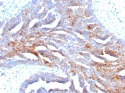 TAG-72 / CA72.4 Monoclonal Mouse Antibody (B72.3)