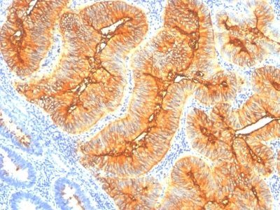 TAG-72 / CA72.4 Monoclonal Mouse Antibody (B72.3)