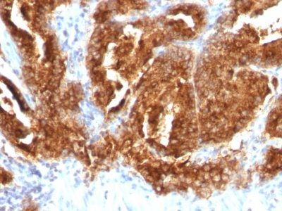 TAG-72 / CA72.4 Monoclonal Mouse Antibody (CA72/733)