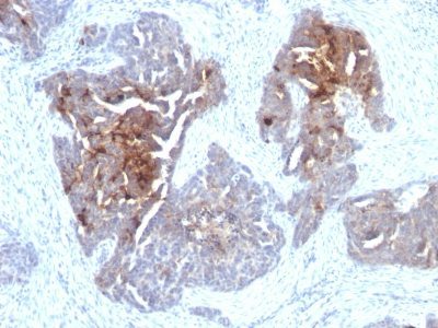 TAG-72 / CA72.4 Monoclonal Mouse Antibody (CA72/733)