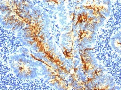 TAG-72 / CA72.4 Monoclonal Mouse Antibody (CA72/733)