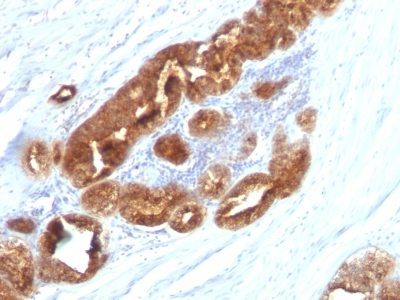 TAG-72 / CA72.4 Monoclonal Mouse Antibody (CC49)