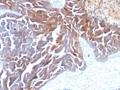TAG-72 / CA72.4 Monoclonal Mouse Antibody (CC49)