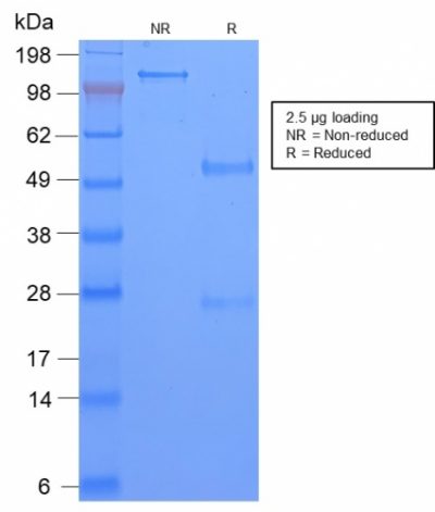 TAG-72 / CA72.4 Recombinant Monoclonal Rabbit Antibody (CA72/2869R)