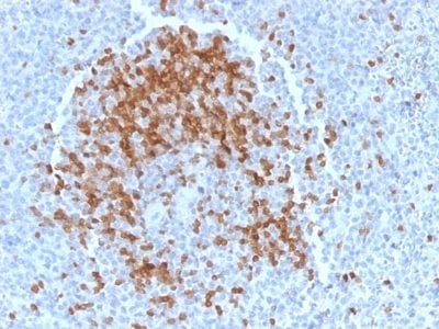 TCL1 Monoclonal Mouse Antibody (TCL1/2078)