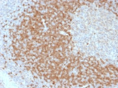 TCL1 Monoclonal Mouse Antibody (TCL1/2078)