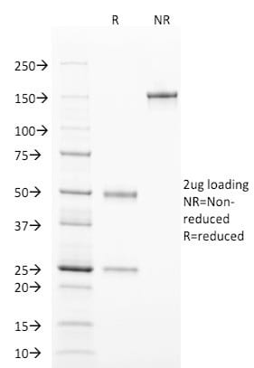 TCL1 Monoclonal Mouse Antibody (TCL1/2078)