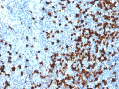 TCL1 Monoclonal Mouse Antibody (TCL1/2079)