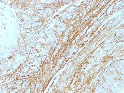 Tenascin C Monoclonal Mouse Antibody (T2H5)