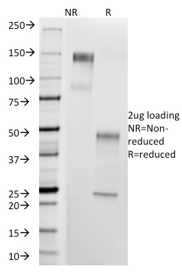 Thomsen-Friedenreich Antigen / CD176 Monoclonal Mouse Antibody (A84-A/F10)