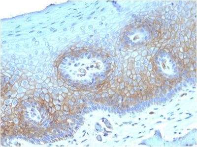 Thrombomodulin / CD141 Monoclonal Mouse Antibody (THBD/1782)