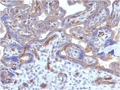 Thrombomodulin / CD141 Monoclonal Mouse Antibody (THBD/1782)