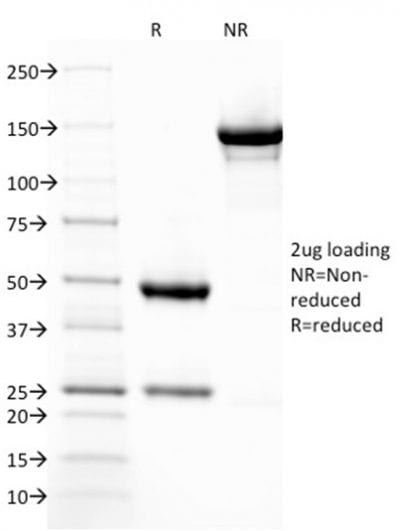 Thrombomodulin / CD141 Monoclonal Mouse Antibody (THBD/1782)