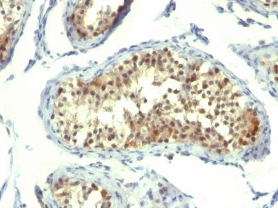 Thymidylate Synthase Monoclonal Mouse Antibody (TMS715)