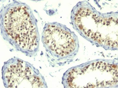 Thymidylate Synthase Monoclonal Mouse Antibody (TS106 + TMS715)
