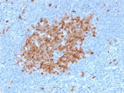 Thymidylate Synthase Monoclonal Mouse Antibody (TYMS/1884)