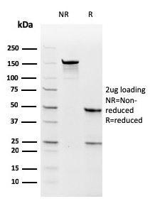 Thymidylate Synthase Recombinant Monoclonal Mouse Antibody (rTYMS/1884)