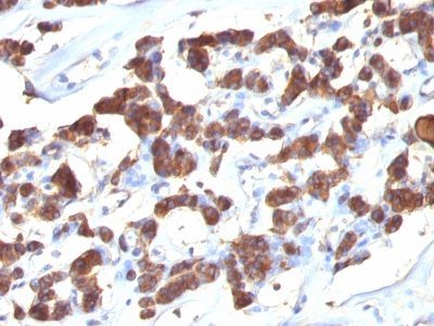 Thyroglobulin Monoclonal Mouse Antibody (2H11 + 6E1)
