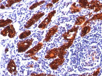 Thyroglobulin Monoclonal Mouse Antibody (2H11)