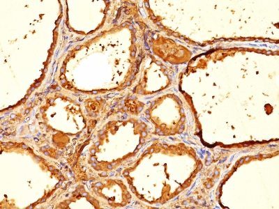 Thyroglobulin Monoclonal Mouse Antibody (6E1.)