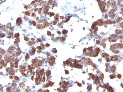 Thyroglobulin Monoclonal Mouse Antibody (TGB04 + TGB05)