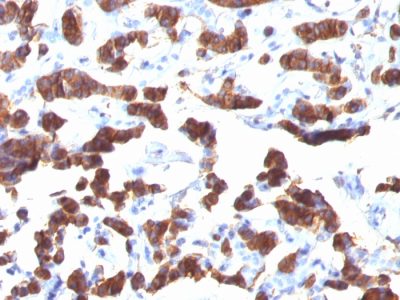 Thyroglobulin Monoclonal Mouse Antibody (TGB24)