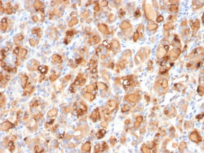 Thyroglobulin Recombinant Monoclonal Mouse Antibody (r2H11)