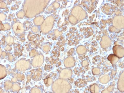 Thyroglobulin Recombinant Monoclonal Mouse Antibody (r6E1)