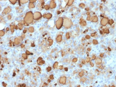 Thyroglobulin Recombinant Monoclonal Mouse Antibody (rTGB24)
