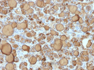 Thyroglobulin Recombinant Monoclonal Rabbit Antibody (TGB/1968R)