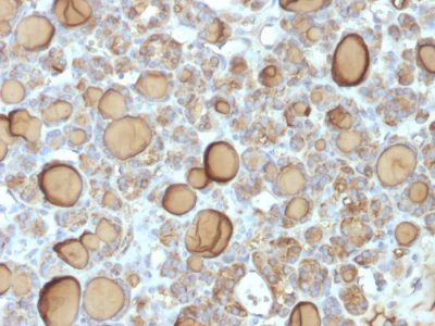 Thyroglobulin Recombinant Monoclonal Rabbit Antibody (TGB/1970R)