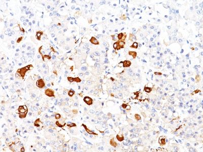Thyroid Stimulating Hormone, beta Monoclonal Mouse Antibody (TSHb/1317)